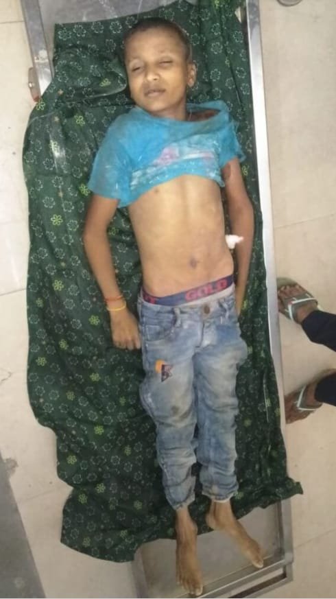 बिलासपुर में आकाशीय बिजली का कहरः खेलते समय 13 साल के दीपक की मौत, दूसरा बच्चा घायल